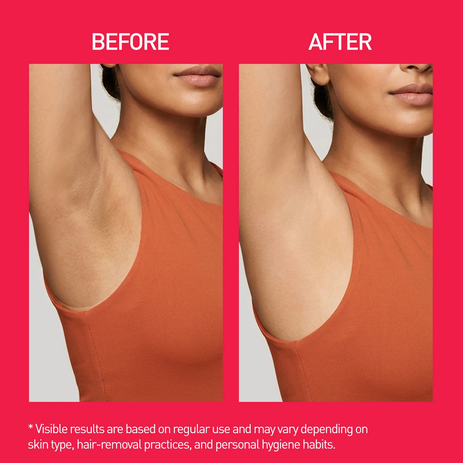 Underarm Roll-On - 50ml - Image 8